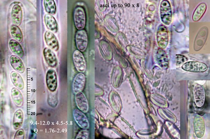 macrostoma