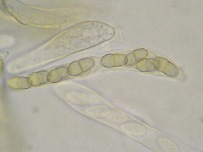 macrostoma