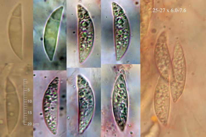 macrostoma