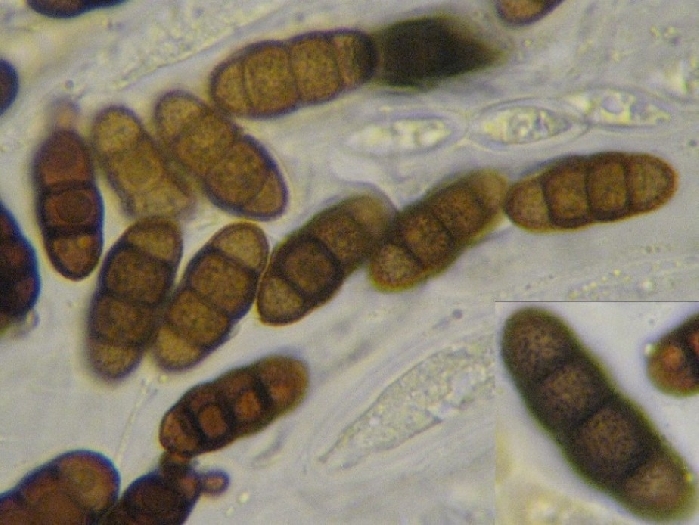 macrostoma