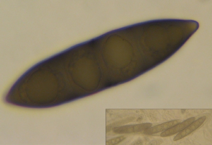 macrostoma