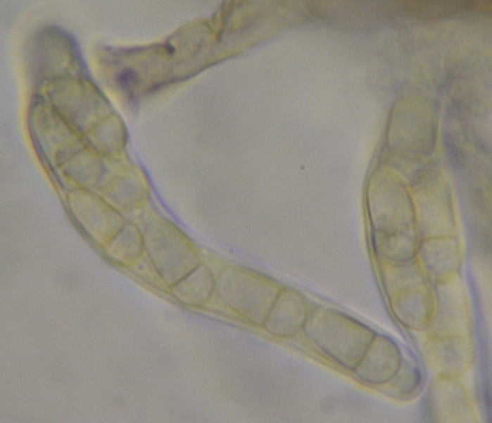 macrostoma