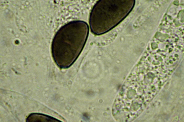 macrostoma