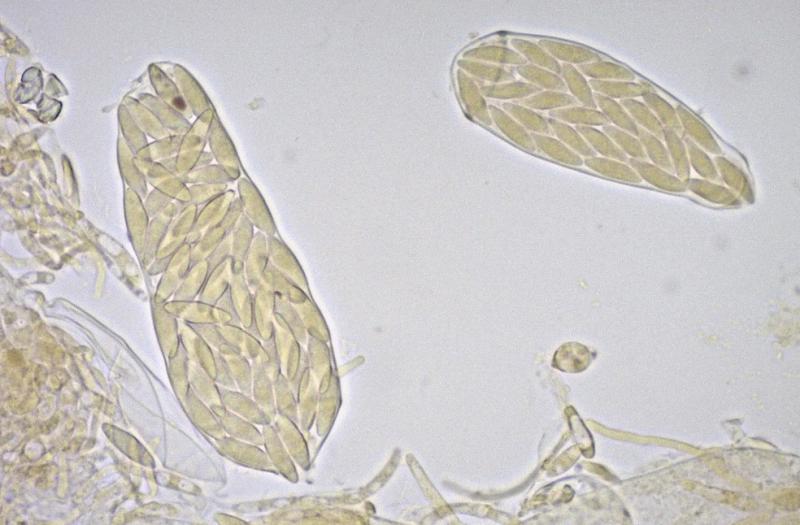 macrostoma