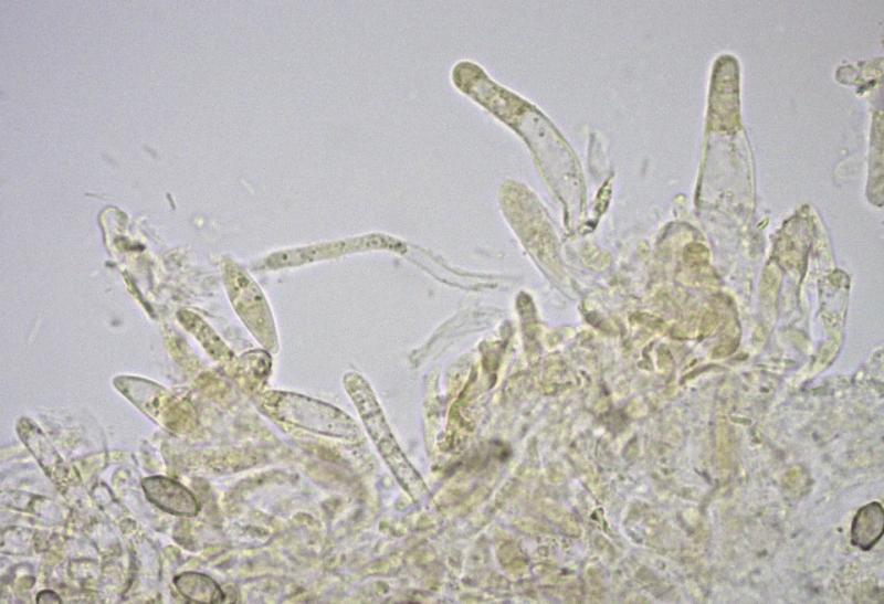 macrostoma