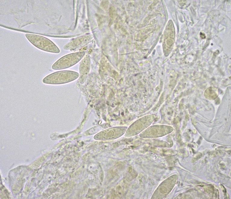 macrostoma