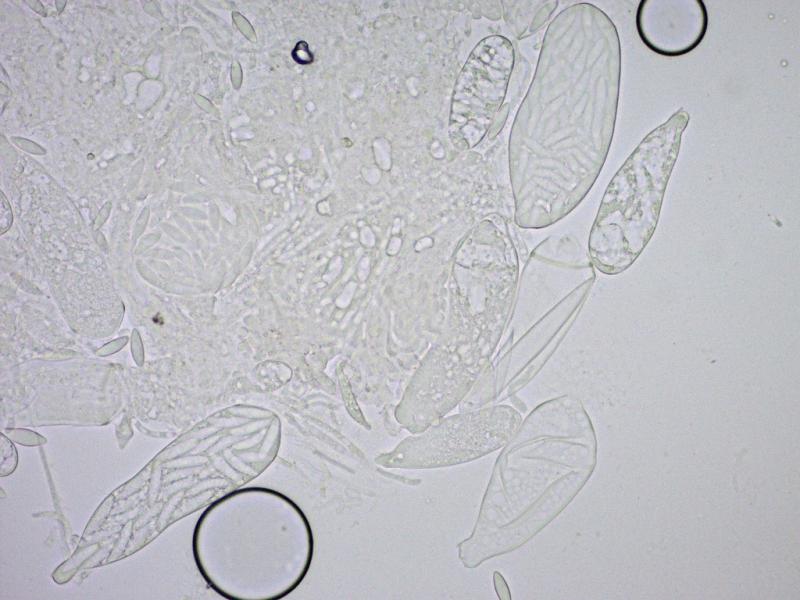 macrostoma