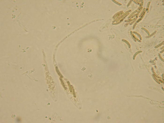 macrostoma