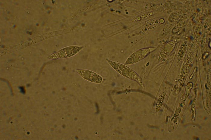 macrostoma