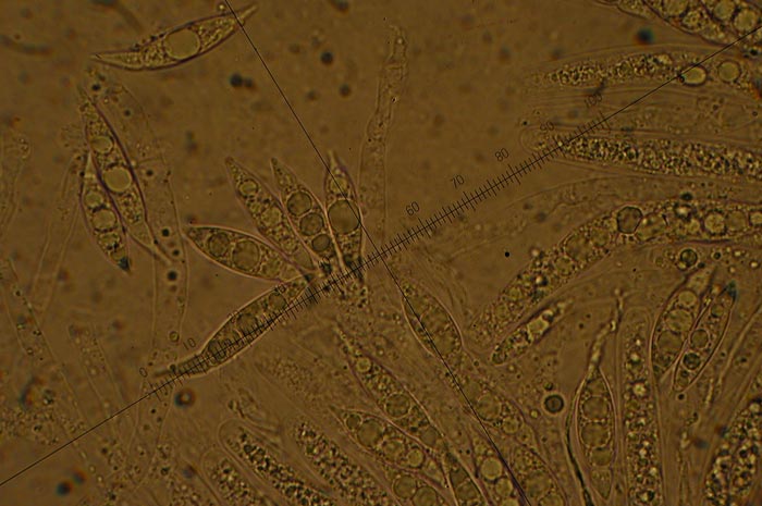 macrostoma