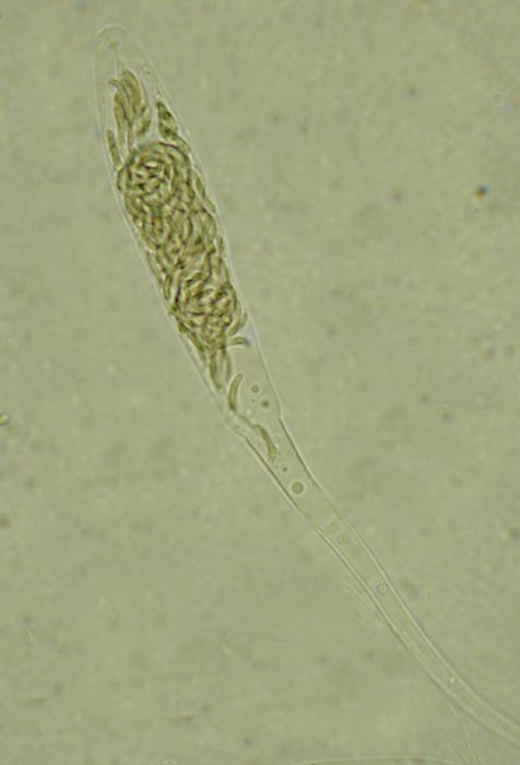 macrostoma