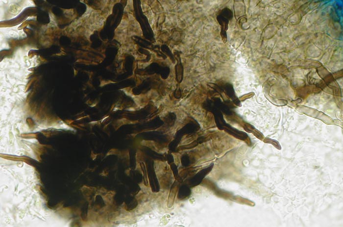 macrostoma