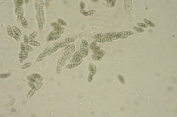 macrostoma