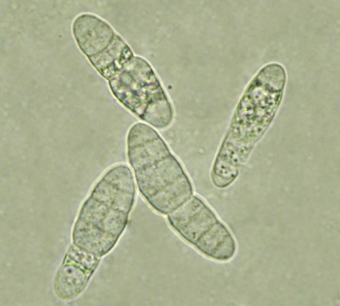 macrostoma