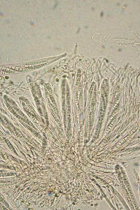 macrostoma