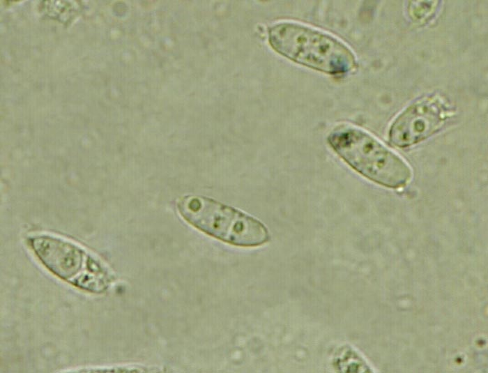 macrostoma