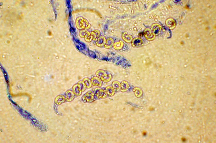 macrostoma