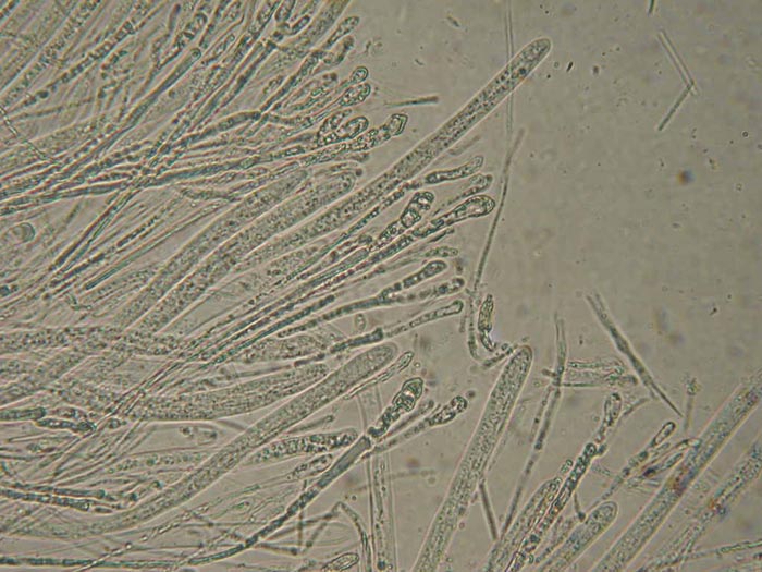 macrostoma