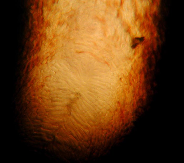 macrostoma