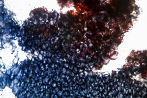 macrostoma