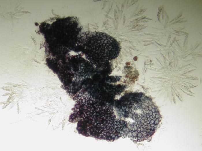 macrostoma