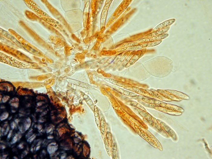 macrostoma