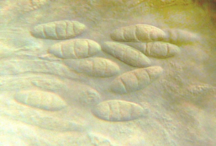 macrostoma