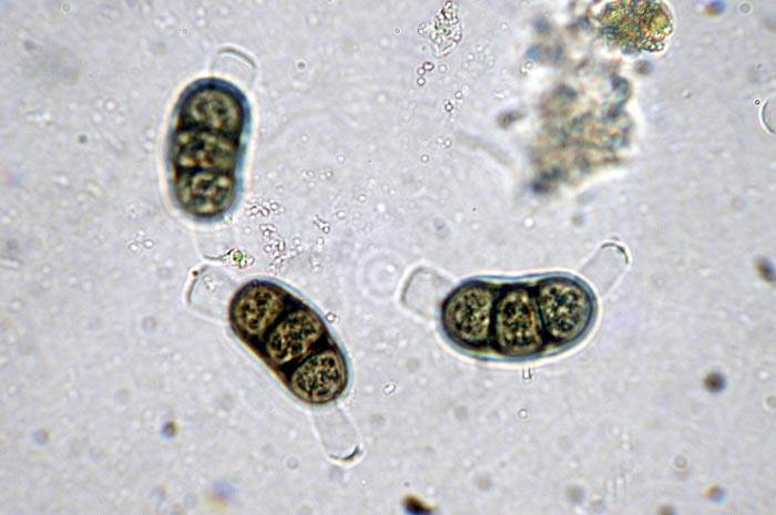 macrostoma