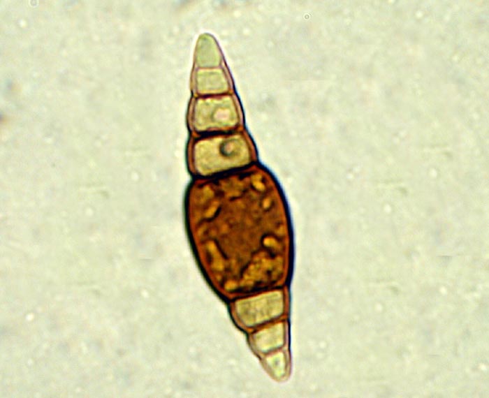 macrostoma