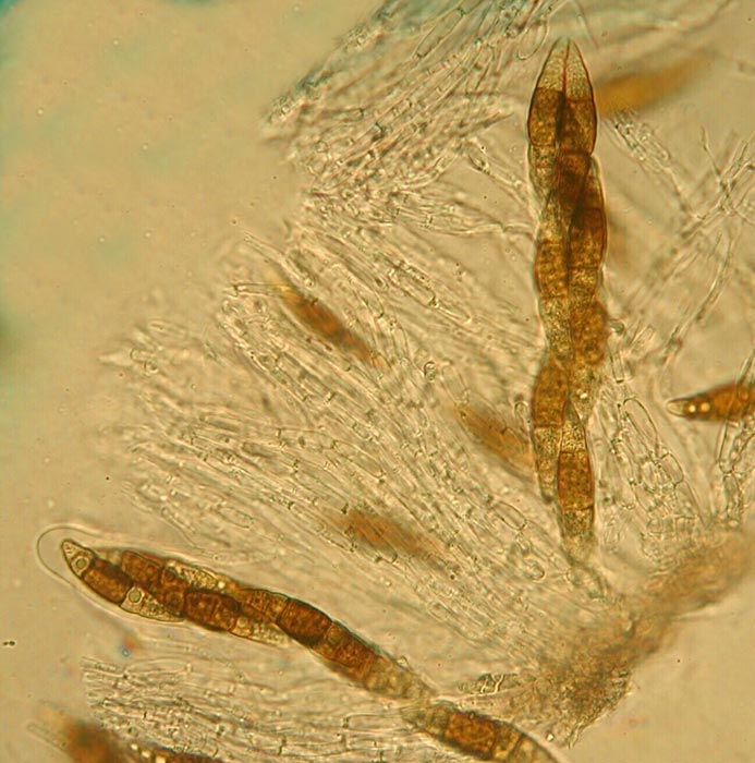macrostoma