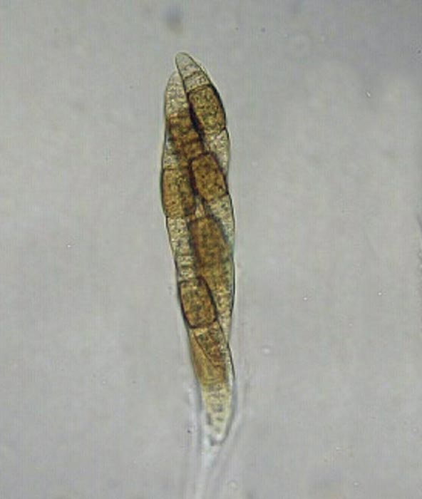 macrostoma