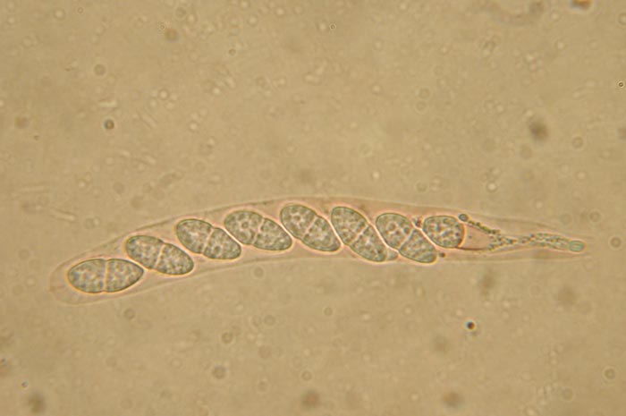 macrostoma