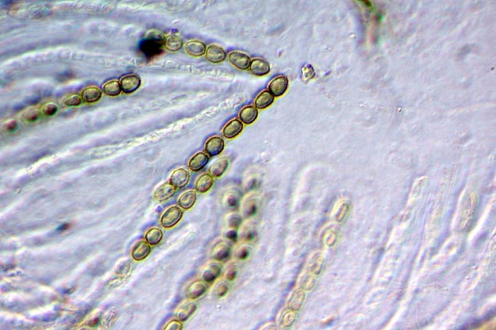 macrostoma