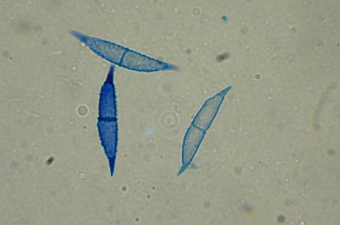 macrostoma