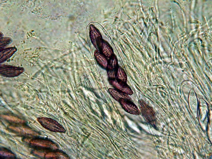 macrostoma