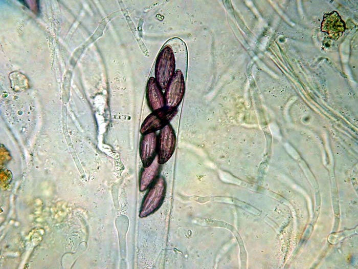 macrostoma
