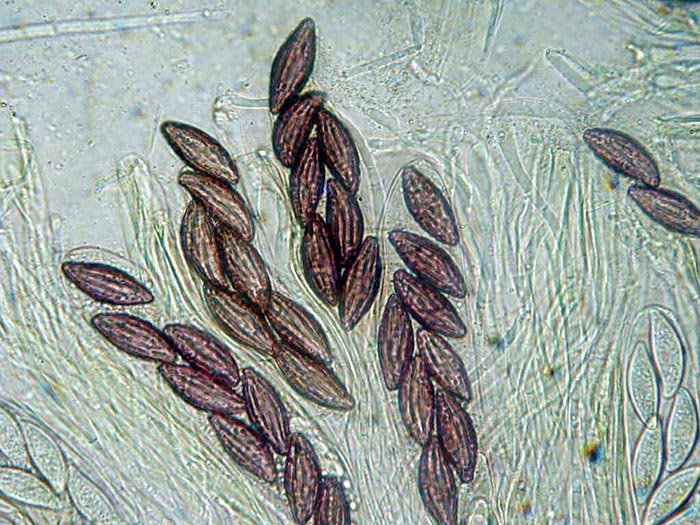 macrostoma