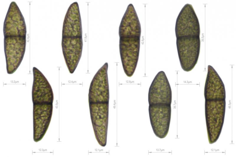 macrostoma