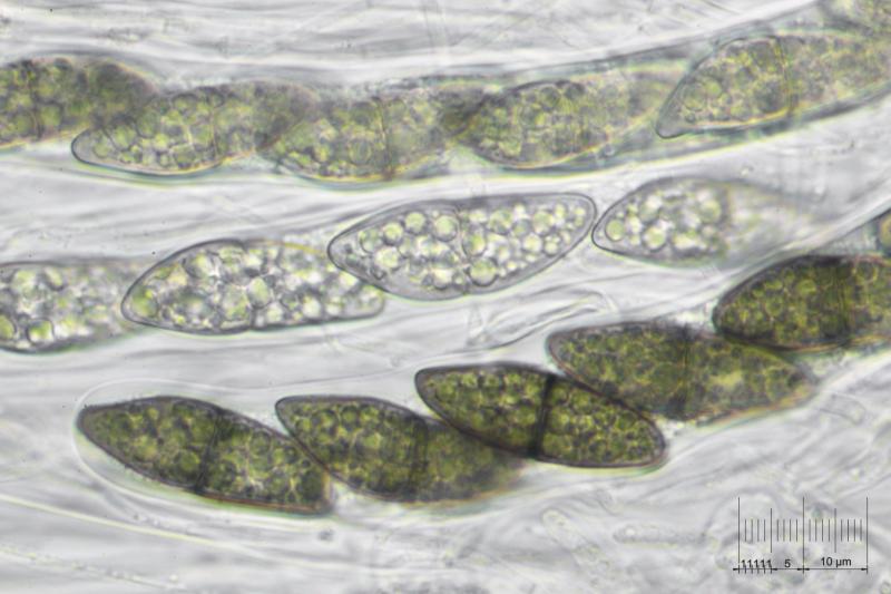 macrostoma