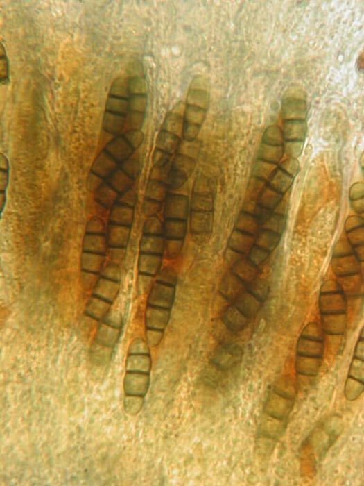 macrostoma