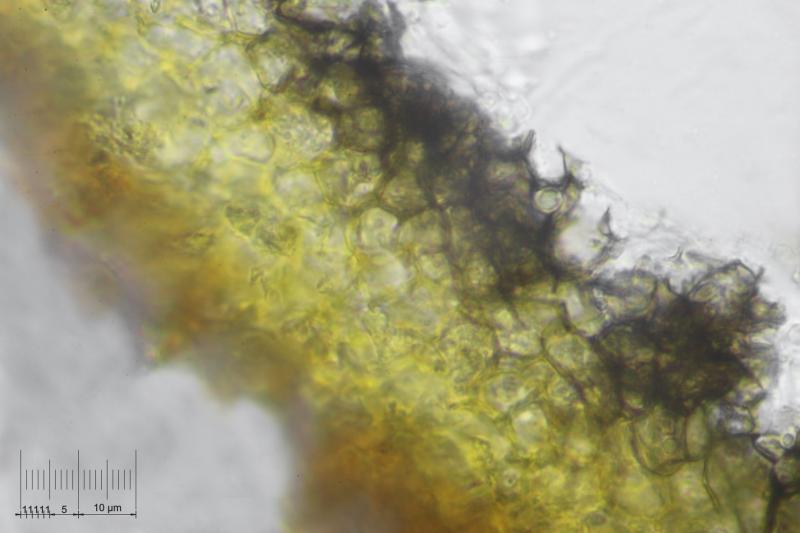 macrostoma