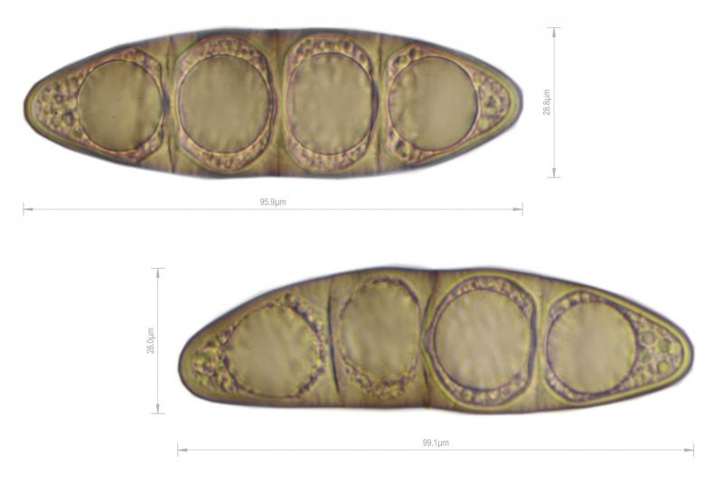 macrostoma