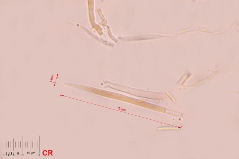 macrostoma