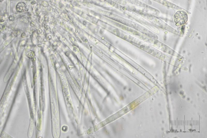 macrostoma