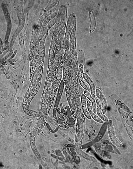 macrostoma