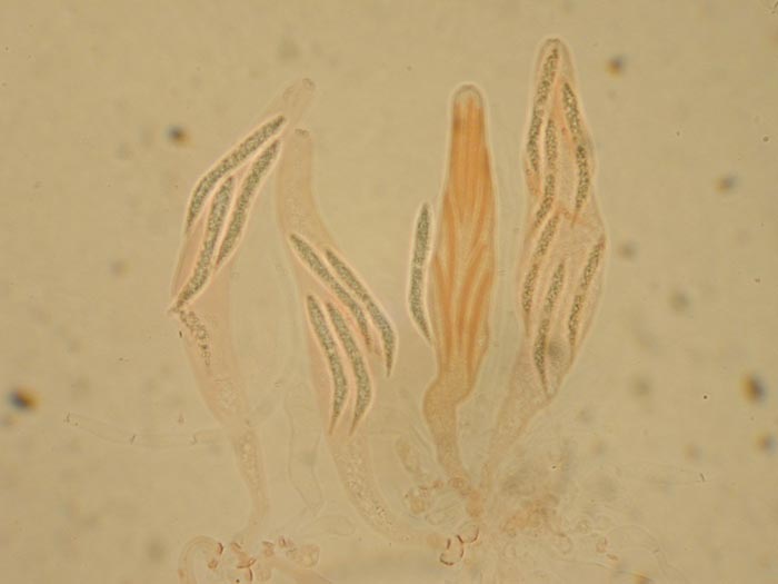 macrostoma
