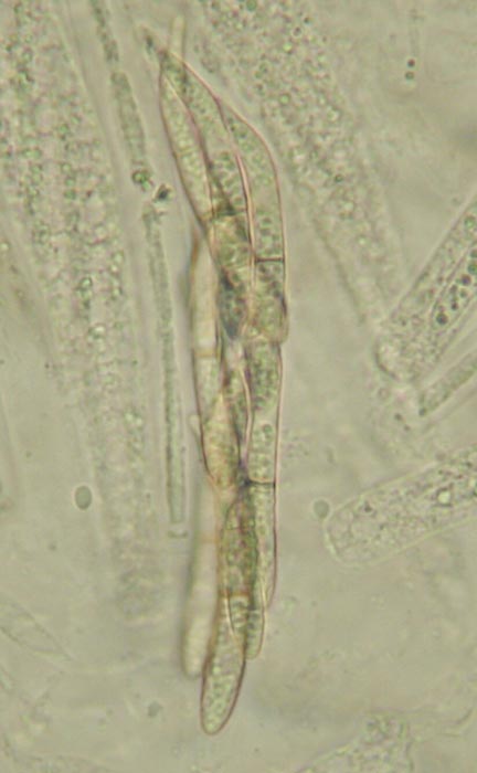 macrostoma