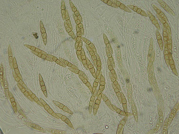 macrostoma