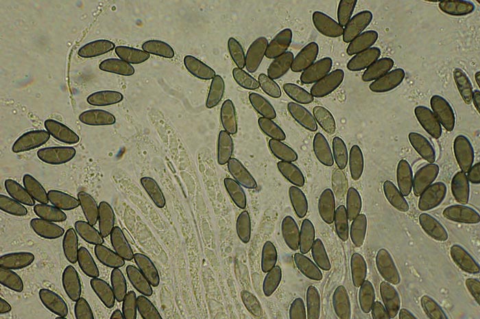macrostoma