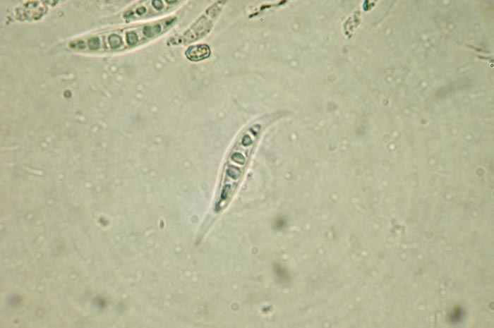macrostoma